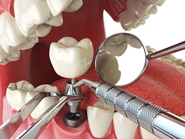 Best Emergency Gum Pain Relief  in Kerman, CA